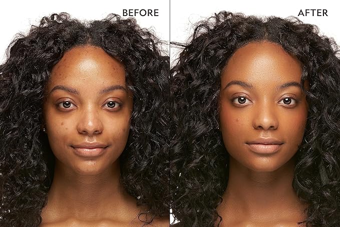 YENSA Skin On Skin BB + CC Full Coverage Concealer - Color Correcting Serum Concealer - Creaseless & Brightening Formula with Hyaluronic Acid & Superfood Complex - Deep Warm (0.34 Fl oz)